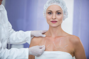 cirurgiaao fazendo marcacoes para cururgia de flacidez nas mamas 